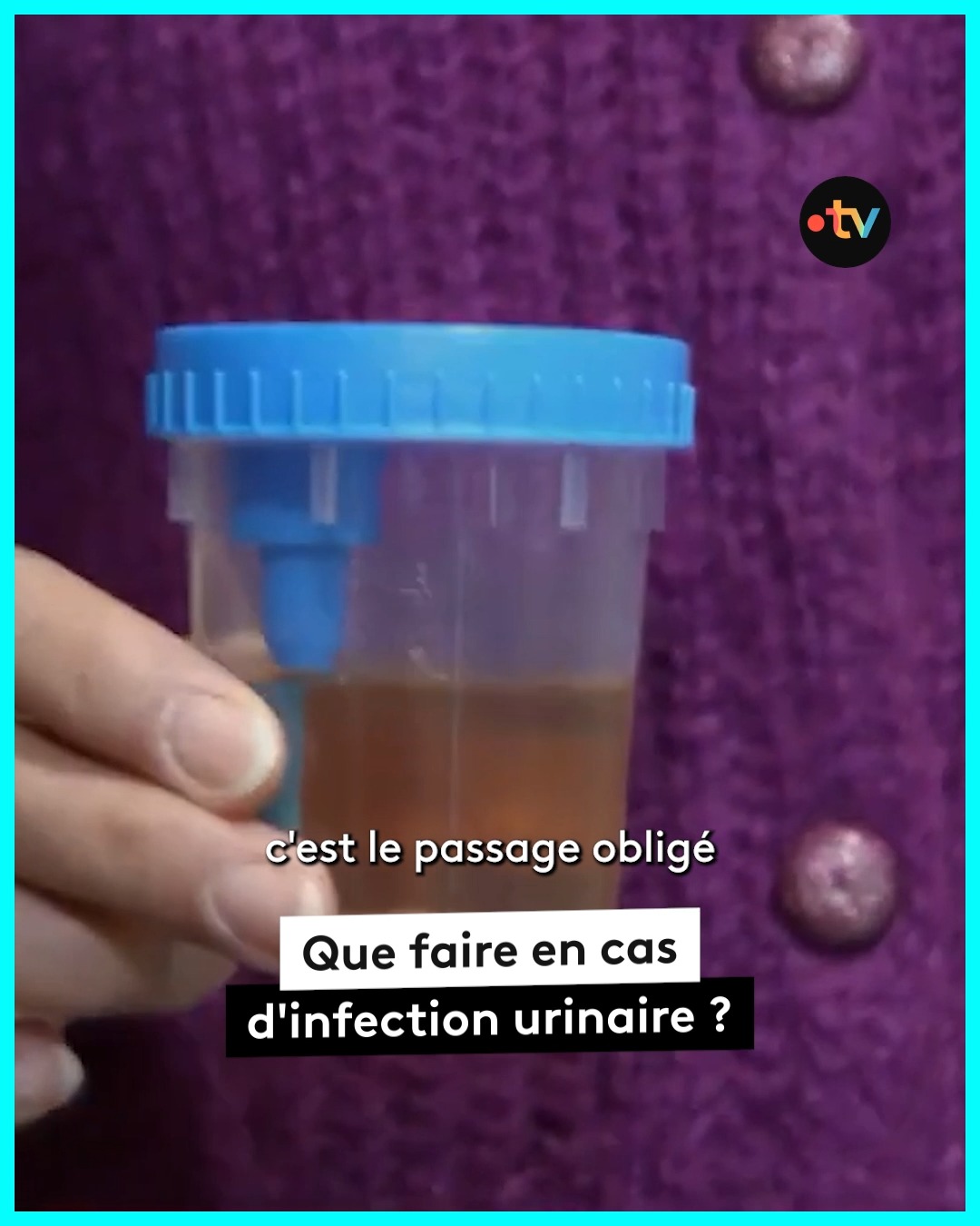 ECBU ou examen des urines : à quoi sert-il ? | Allo Docteurs - Le Mag ...