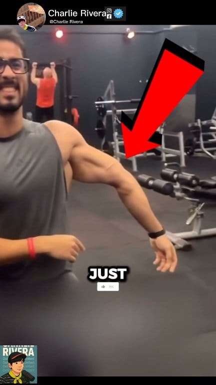 He Saved Him Arm 🥶 #OMG #gym #bodybuilding #everyoneシ゚ ...