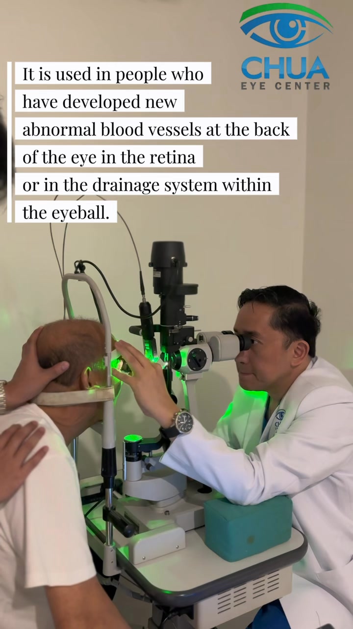 Panretinal Photocoagulation (PRP) laser treatment is done to stop ...