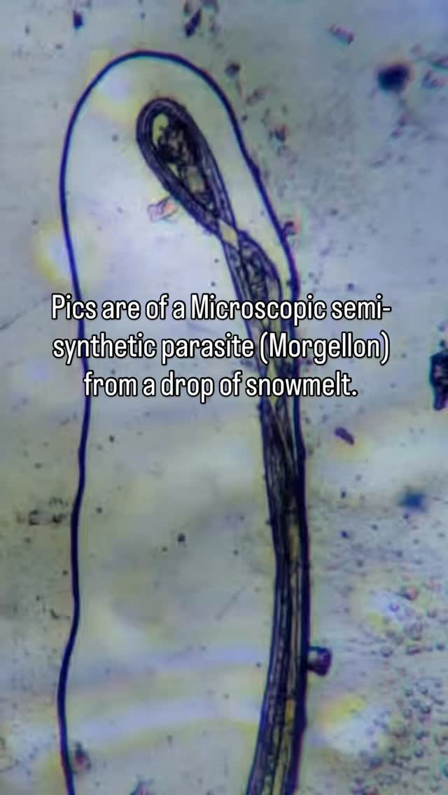 THIS is Morgellons nanotechnology “parasites” in medical masks , PCR ...