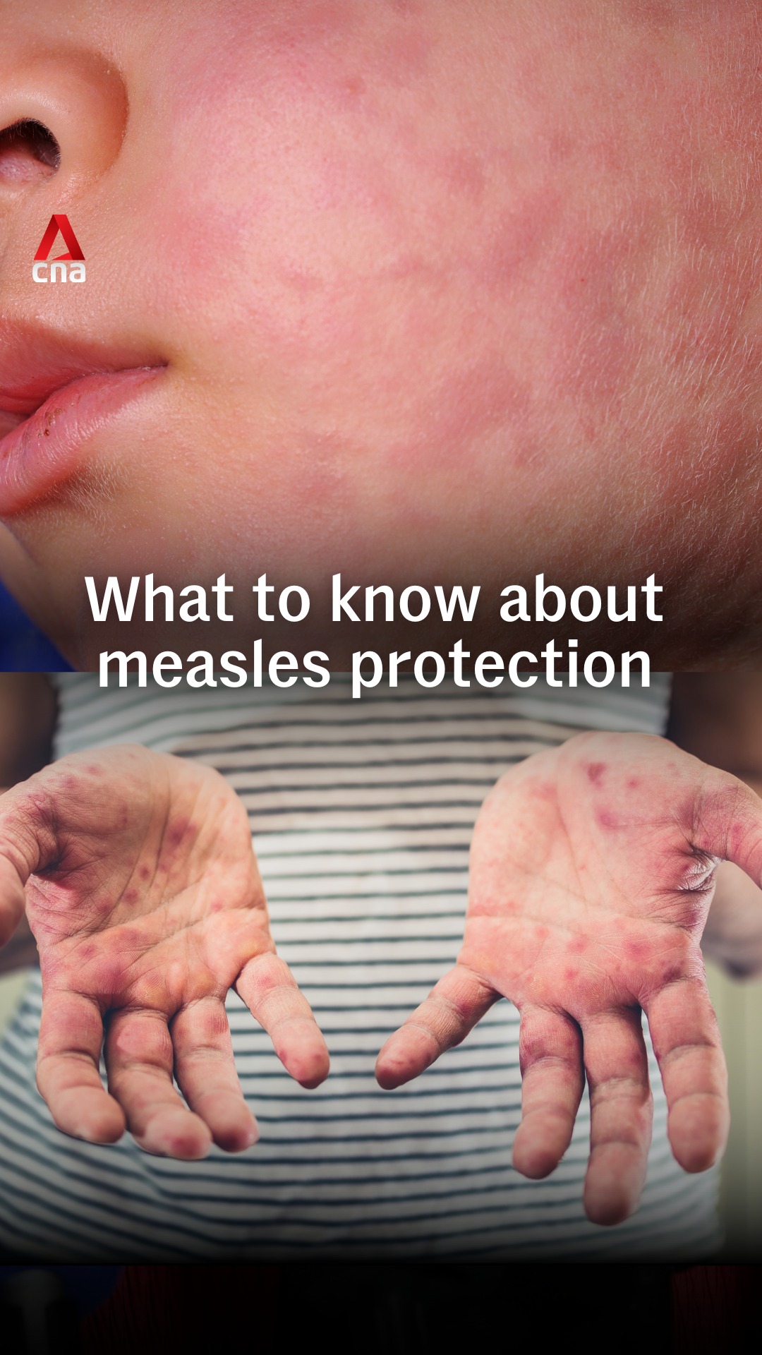 Two doses of the measles, mumps and rubella (MMR) vaccine after 12 ...