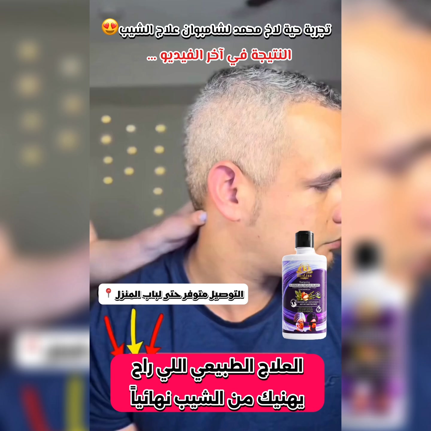 🌿 شامبو Bio Liss… طبيعي %100 لإزالة الشيب خايف من المواد الكيماوية في ...