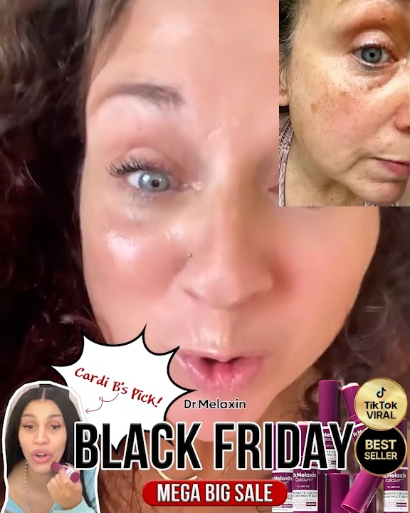 Cardi B’s actual pick is finally here — the Dr. Melaxin Calcium Volume Multi Balm 💥, This little stick is going viral for a reason. One swipe and areas like:, • Jawline • Smile lines • Crow’s feet • 
