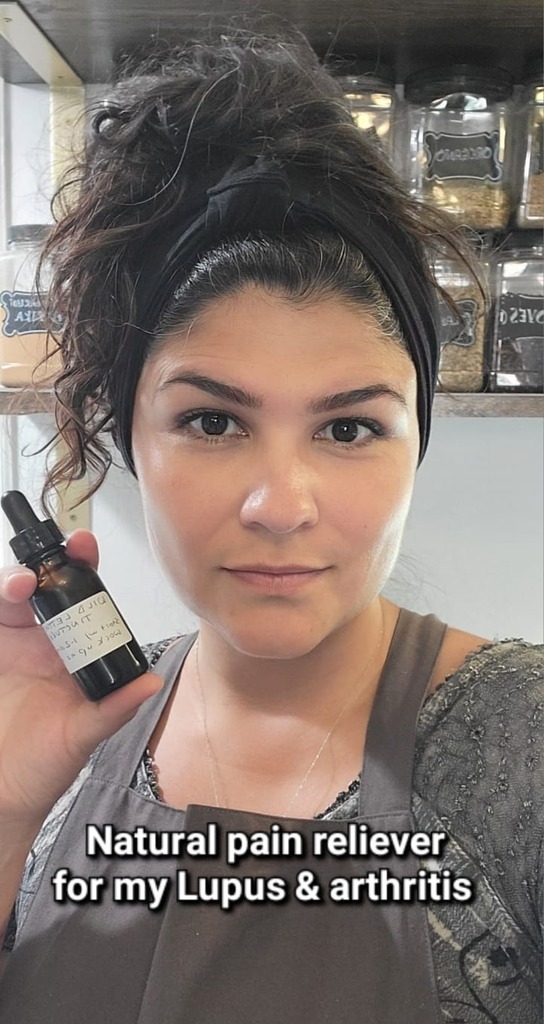 Natural ways to treat lupus?