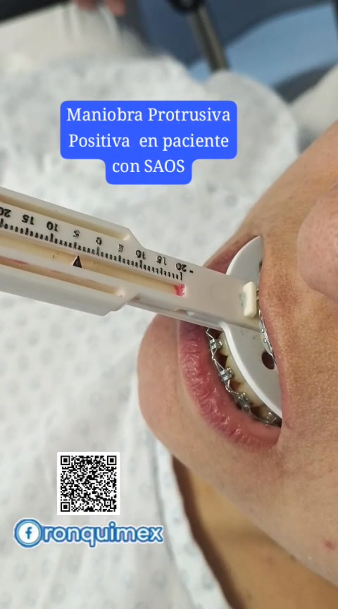 Roncar no es dormir bien...y una de las pruebas utilizadas en la ...