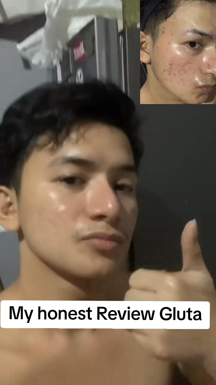 glutathione whitening soap reviews Honest Review Quantity:8oz glutathione measurement in cultured kojic soap with gluta