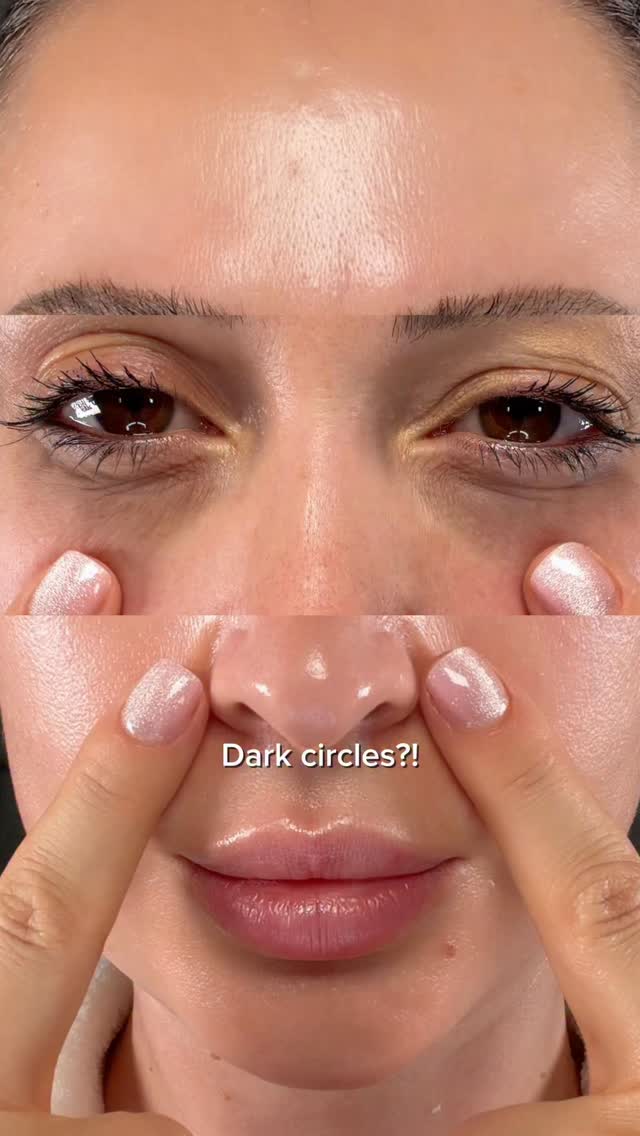 glutathione dark circles My skin needed this ✨, Kojic Acid Eye Patch Vita Jelly, Brightens & refreshes dull-looking skin 🍊 Abib Cosmetics , #abibeyepatch #vitasticker #darkcircles #glutathione veg can i use glutathione Choose Your Bundle::8oz | 25Pack This glow eye cream