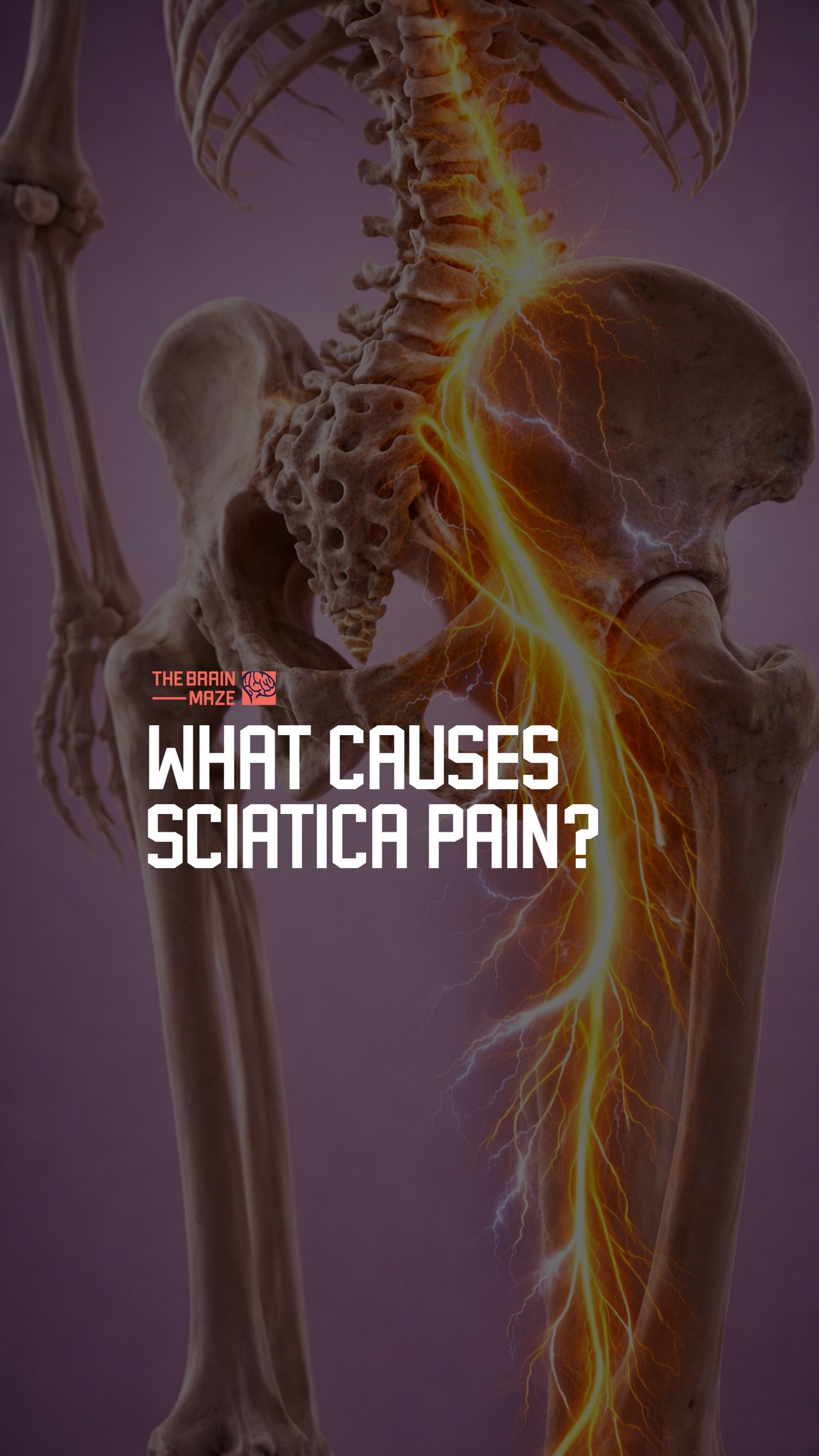 l carnitine sciatica What Causes Pain?, - What if that sharp, burning pain down your leg is your sciatic nerve and there are simple ways to ease it? | The Brain Maze Comprar HIGO TINTO polvo Size:1 box LABOR DAY