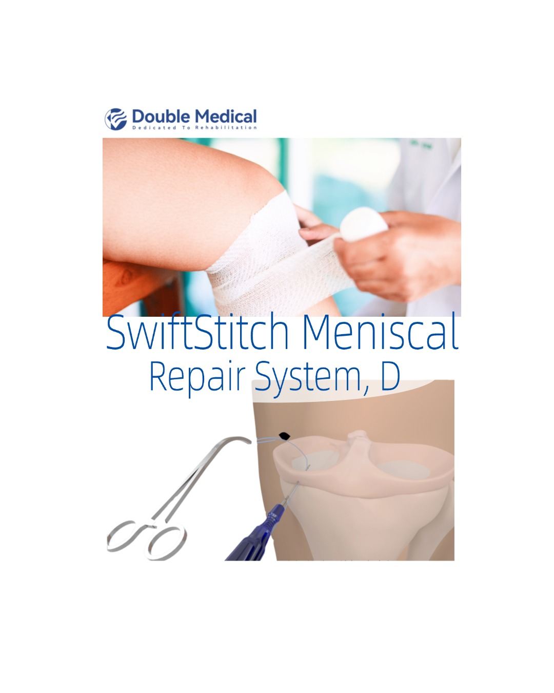 The Infinity AIM™ Meniscal Repair Device delivers a safer, smarter approach to meniscal repair. From its retractable sheath to its one-handed deployment every detail is engineered