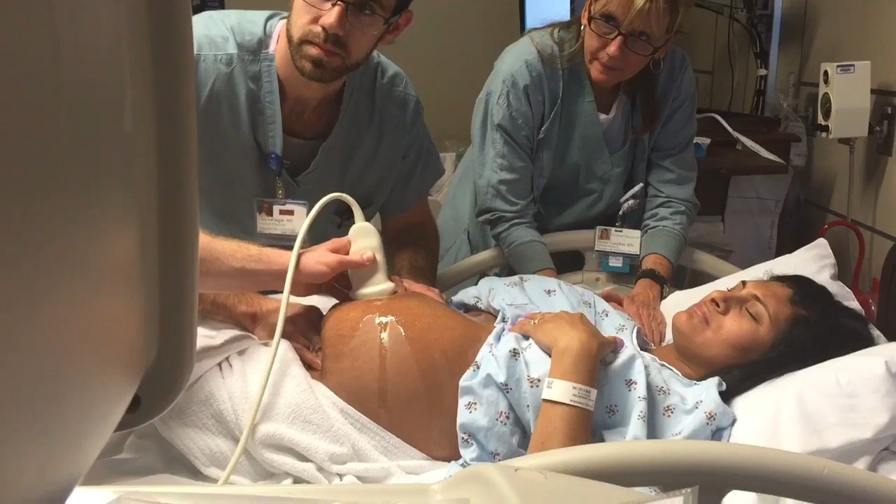 Doctors Use External Cephalic Version to Turn Breech Babies Before ...