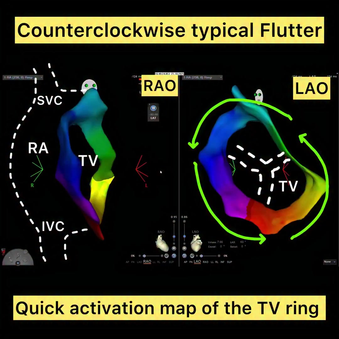 🚩 Rapid Single-Trip Mapping Confirms Counterclockwise CTI-Dependent ...