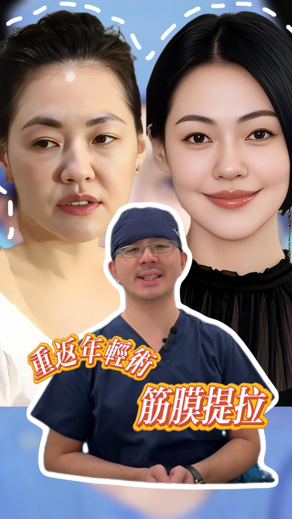 面部抗衰選什麼？試試藝人都在推薦的筋膜提拉，一次提升年輕十歲 #五層筋膜提升 #醫美 #面部提升 #NaturalFacelift #面部年輕 ...