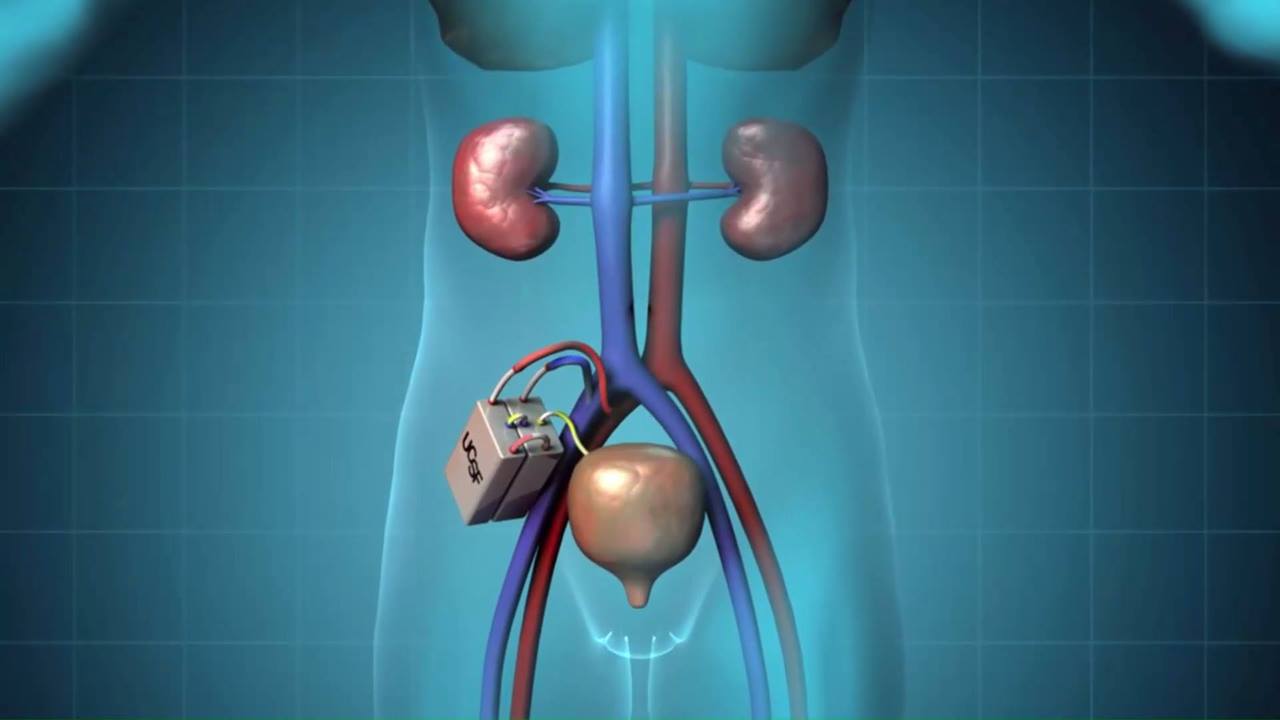 The Kidney Project at UCSF. | kidney, University of California, San ...