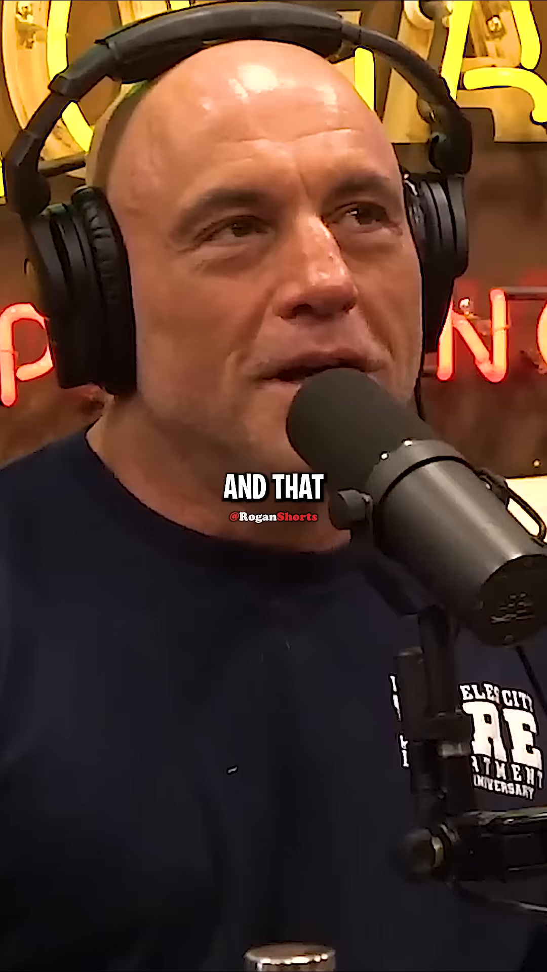 Joe Rogan on Hair Transplant | The Joe Rogan Experience Fans | Facebook