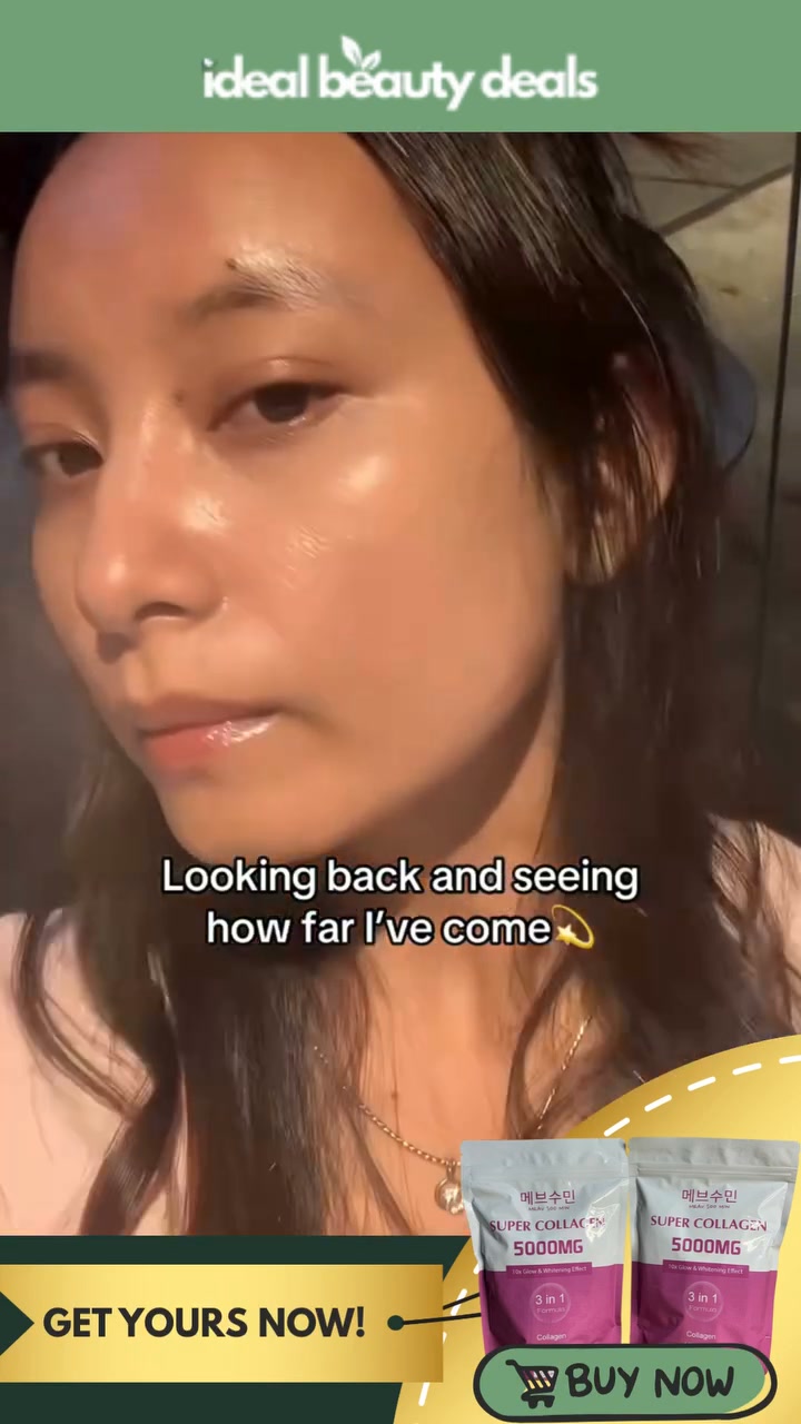 ureshii glutathione Glow inside and out with and Give your skin the nutrients it deserves with Super Collagen 5000mg. The perfect complement to your daily routine. | Ureshii Capsule Saudi sustained release l-glutathione Variant:20mg wells fargo dsip review