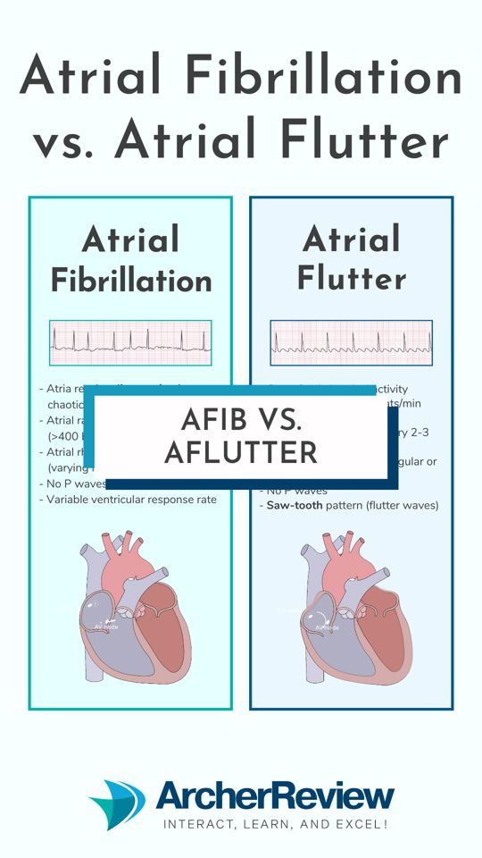 Let's review some key differences between atrial fibrillation vs ...