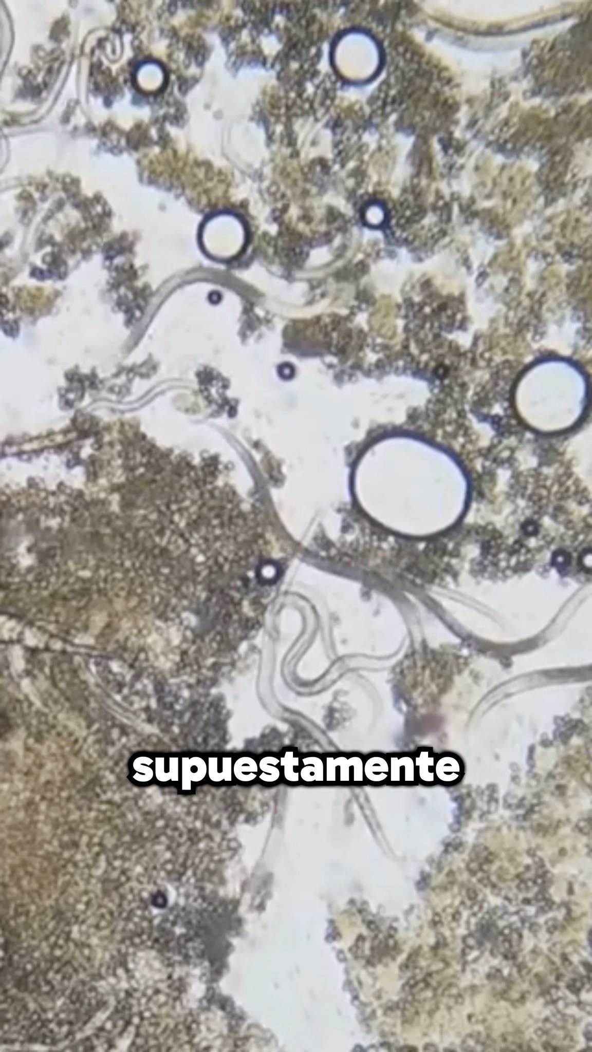 Así Se Ve Un Hot Dog Bajo Un Microscopio?! #DatosCuriosos #Microscopio ...