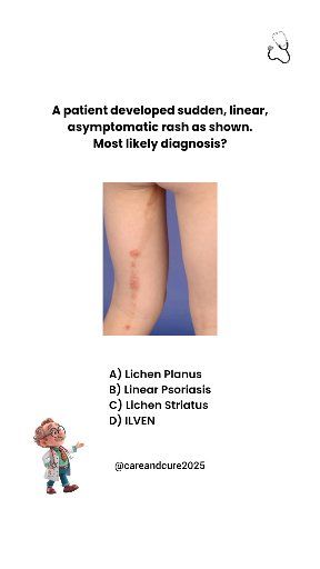 Can you name this Linear Rash? . . . . #medical #health #medstudent # ...