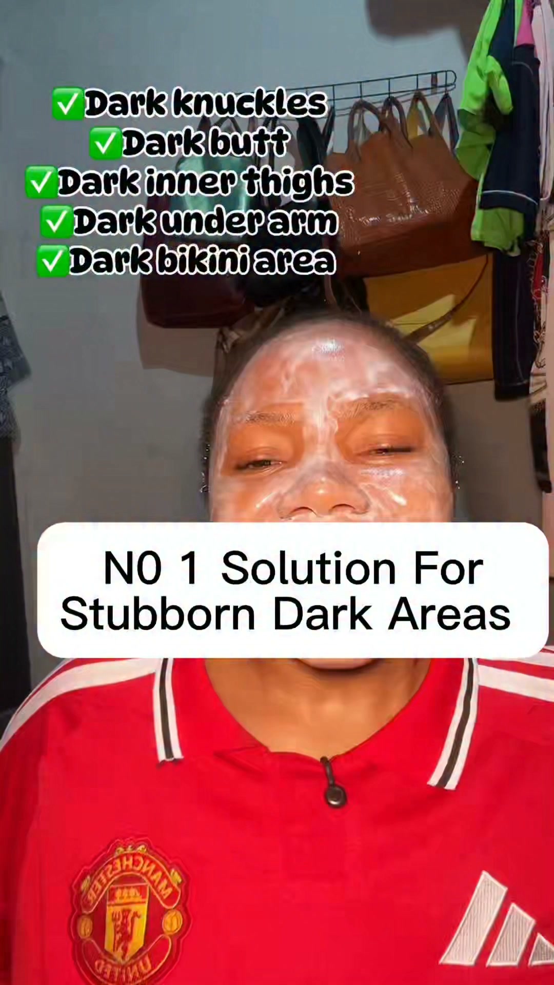 glutathione for dark knuckles Knuckles? It’s Time a Change! ✨, Stubborn dark knuckles, knees, elbows or inner thighs? 💯, Try Exclusive Glow™️ Advanced Dark Corrector Cream — specially formulated with Alpha Buy Luke warm sunscreen BPC-157 ARG Peptide for Flavor:Cacoa Mint