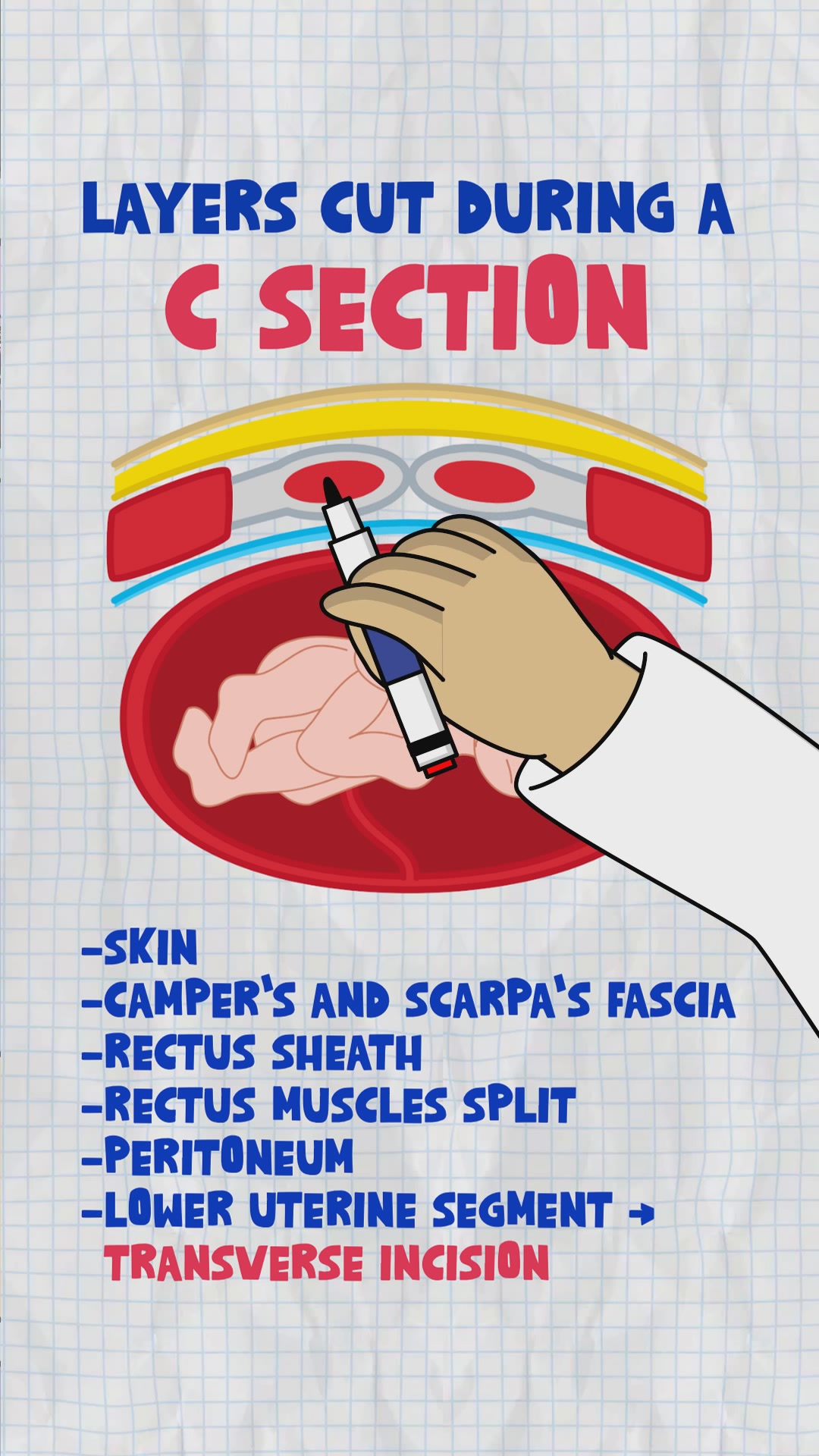 Draw the Circle of Willis in under 60s! ⭕️ Find this + lots more in my ...