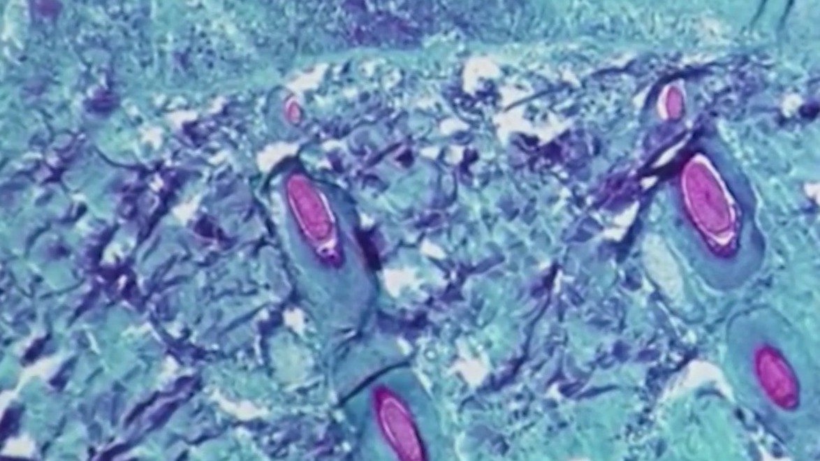 As fall weather moves across the country, so are cases of COVID-19 ...