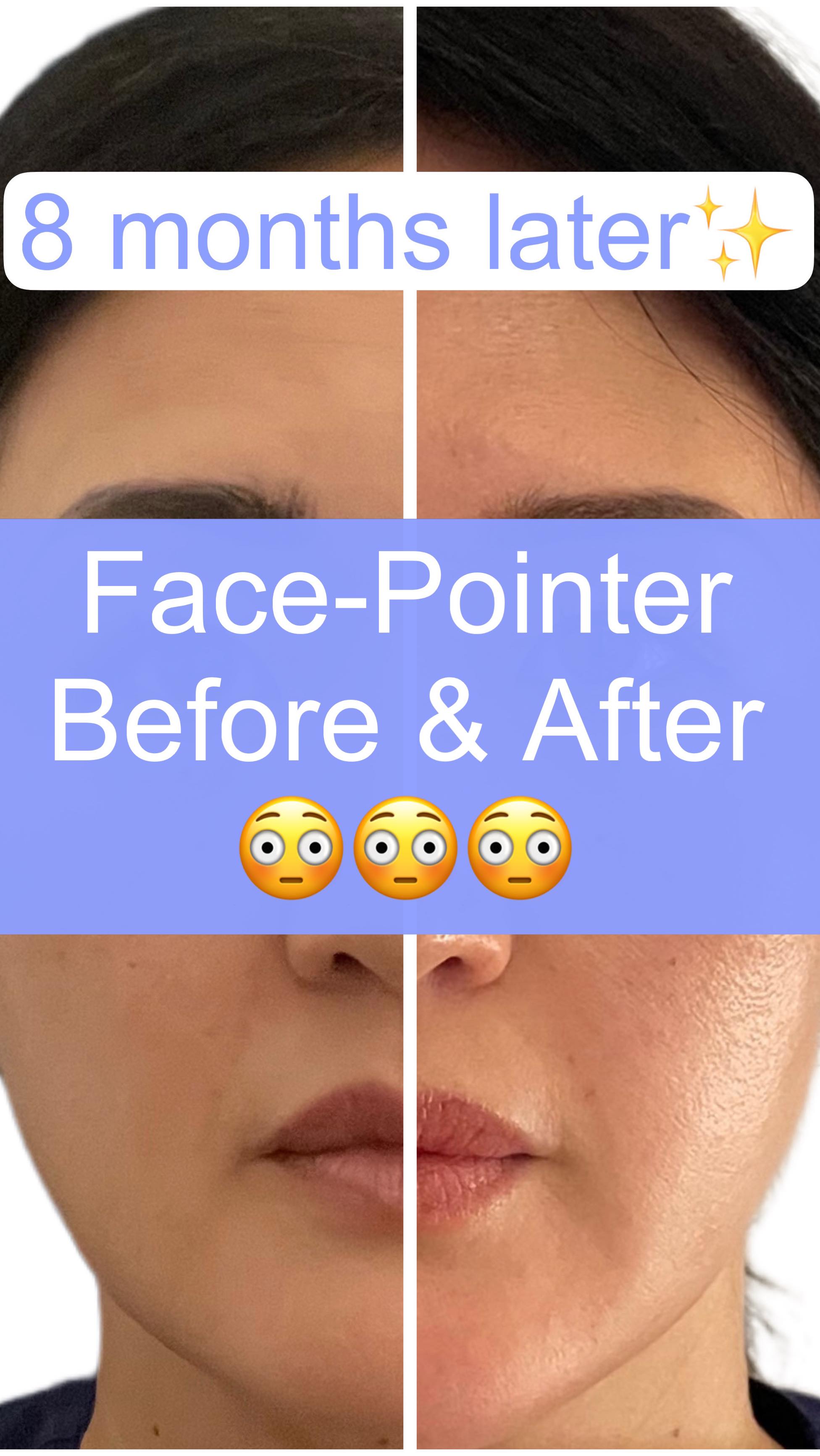 Before & After using Face-Pointer by CoreFit✨ Look at my face