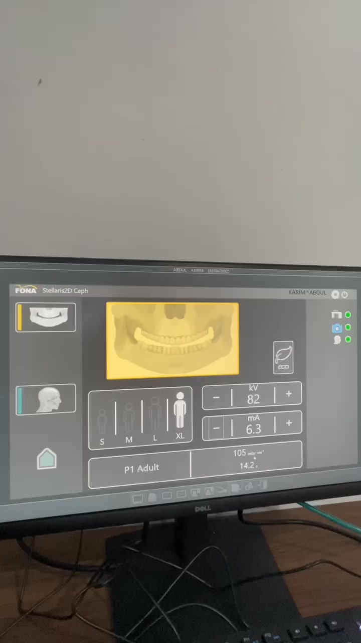 X-ray portable 100ma mantap🔥🔥 #xray #carixray #ronsen #mcu #diagnos #tb ...
