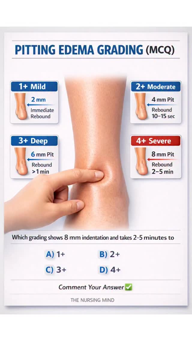 Pitting edema grading is a must-know NCLEX assessment skill 🩺 As a ...