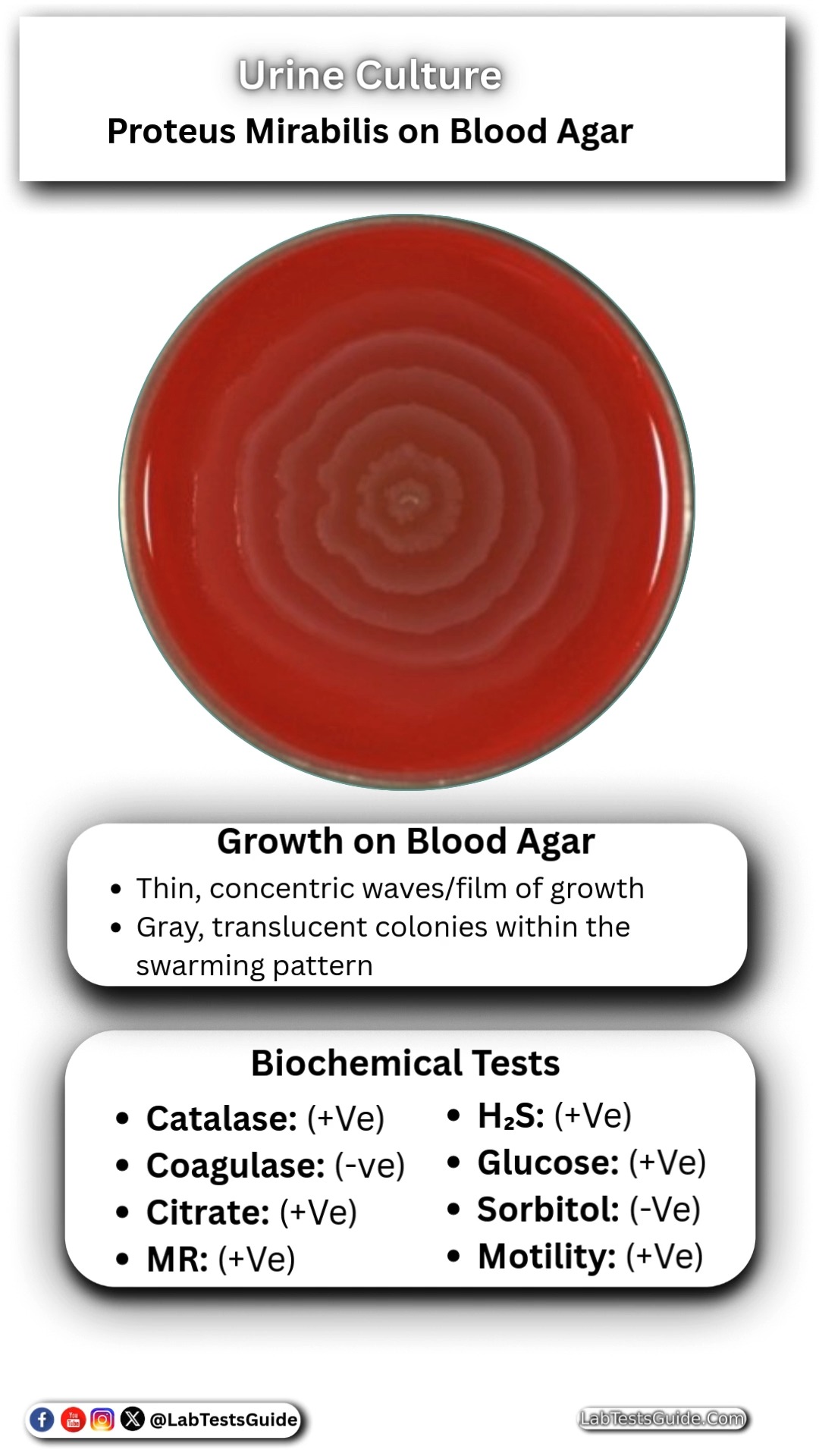 Proteus Mirabilis on Blood Agar in Urine | Lab Tests Guide | Facebook