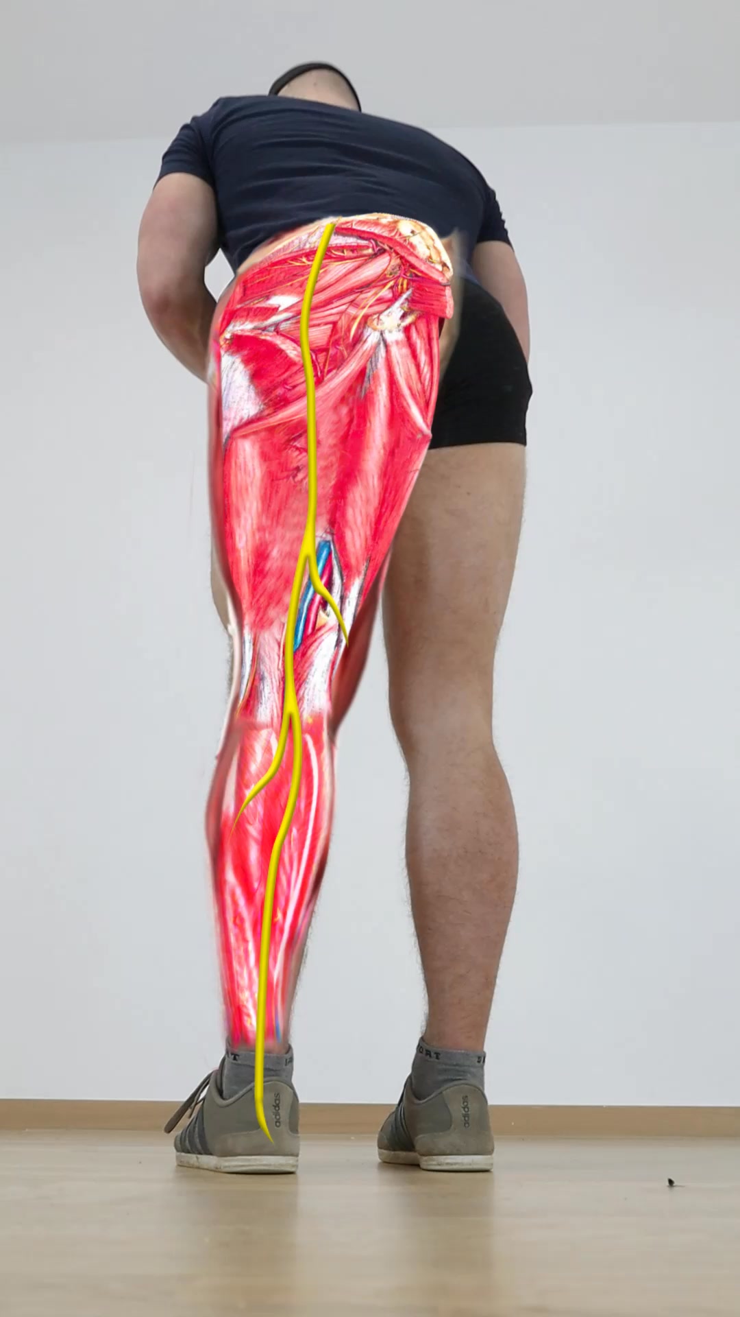 Recover Pain - 💥 Sciatica Flare Up?? Do This #sciatica | Facebook