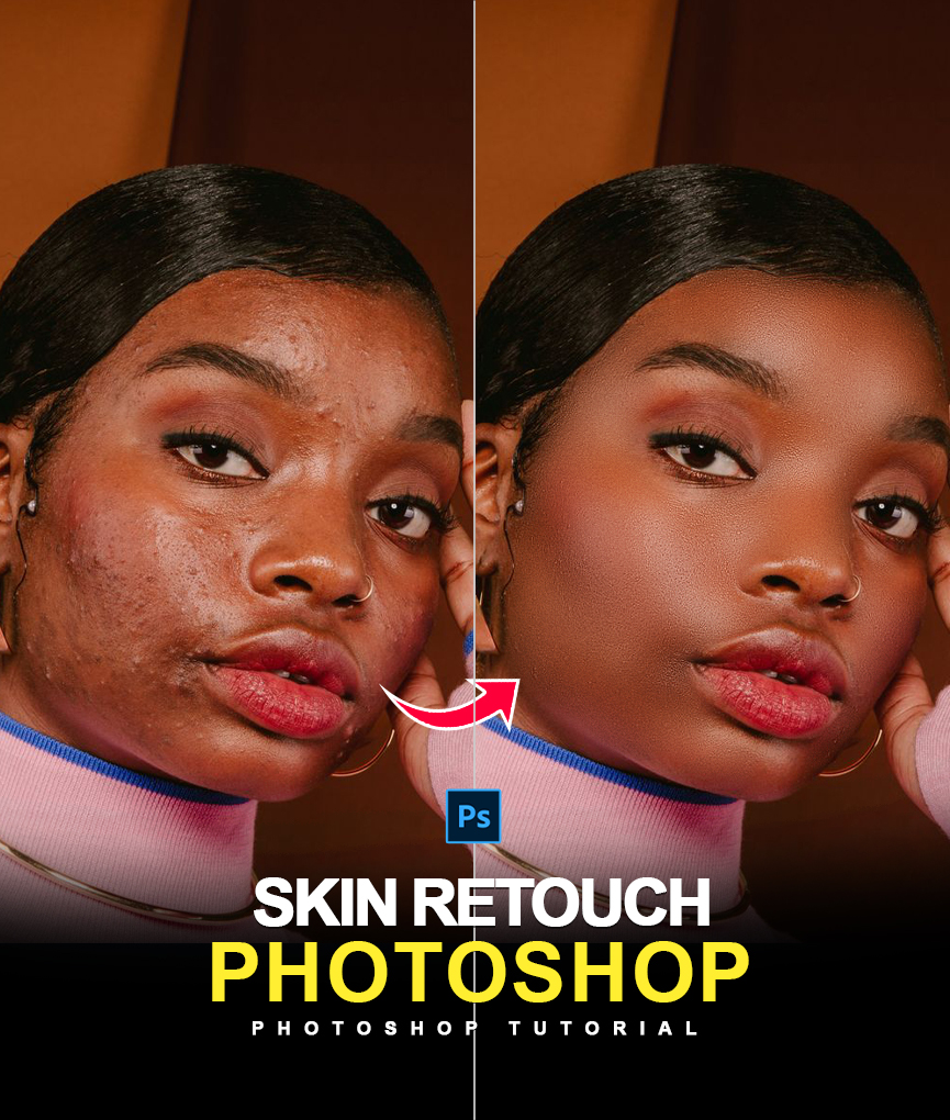 #Photoshop New Method | Easy Way Skin Retouch Using Frequency in ...