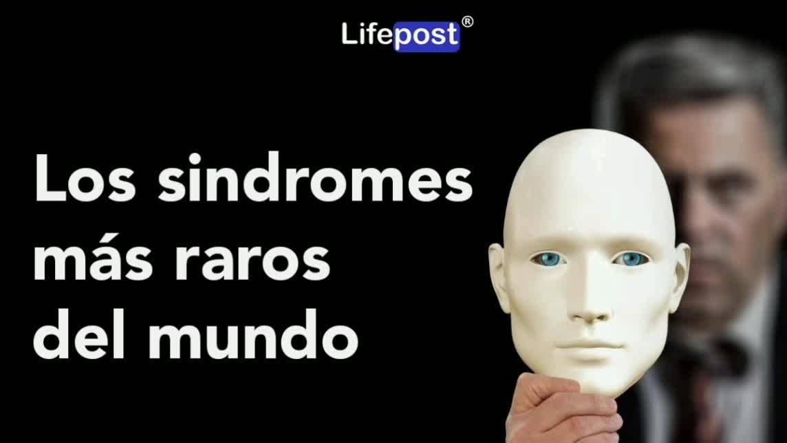 Conoce algunos de los síndromes más raros del mundo 😲 | ¡Hoy te ...