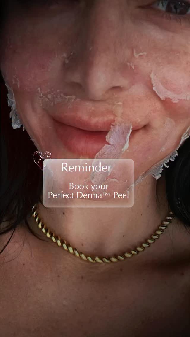 Have you booked your Perfect Derma™ Peel yet? , Interested in getting a Perfect Derma™ Peel? , Click 👆the link in our Bio to find an authorized provider in your area📍, . , ., ., ., #peel #chemicalpeel 