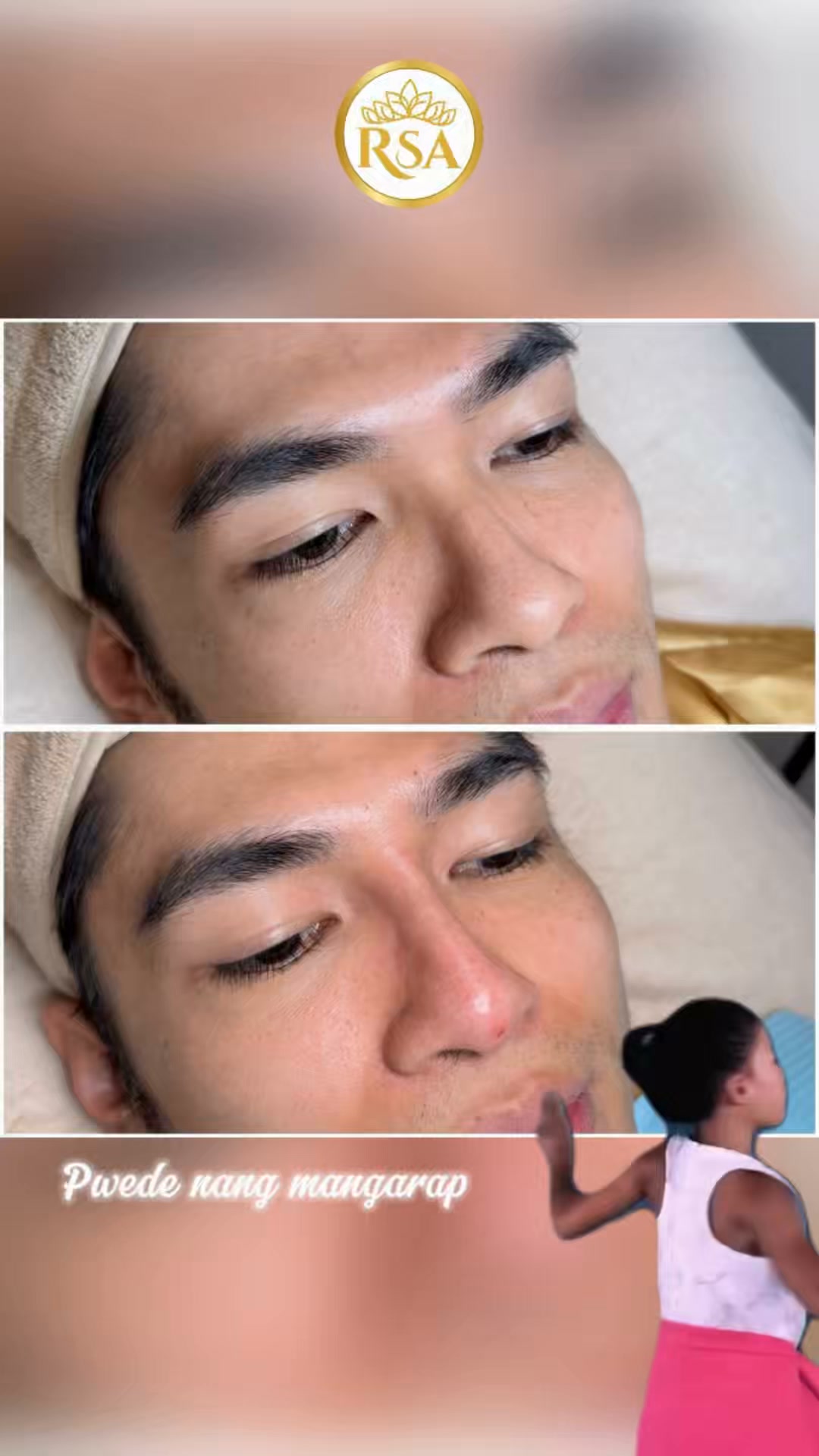 Tips before doing your glutathione Drips. - Dont drink coffee after your drip at least 24hrs. - Avoid direct sunlight