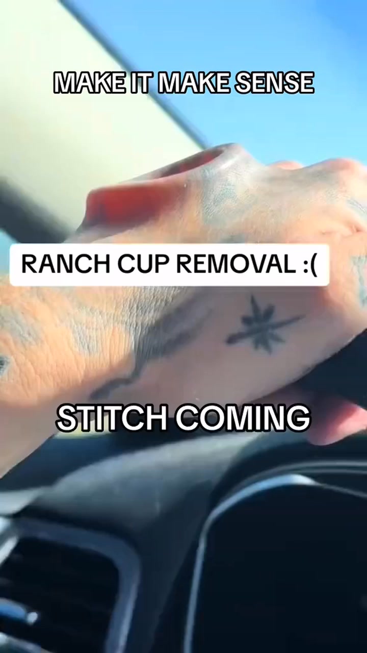 Insane Ranch Cup Removal 😮 #reaction #2024 #tattoos #wtf #fblifestyle ...