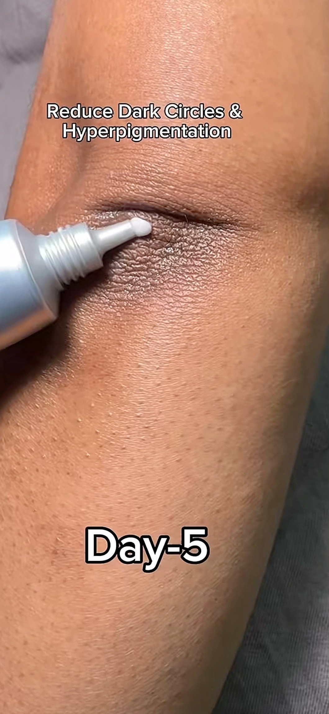 Mary&May Tranexamic Acid + Glutathione Eye Cream is packed with gentle yet powerfully ingredients: 💧 Glutathione – reduces melanin and evens skin tone 🌟 Tranexamic Acid (TXA) – brightens