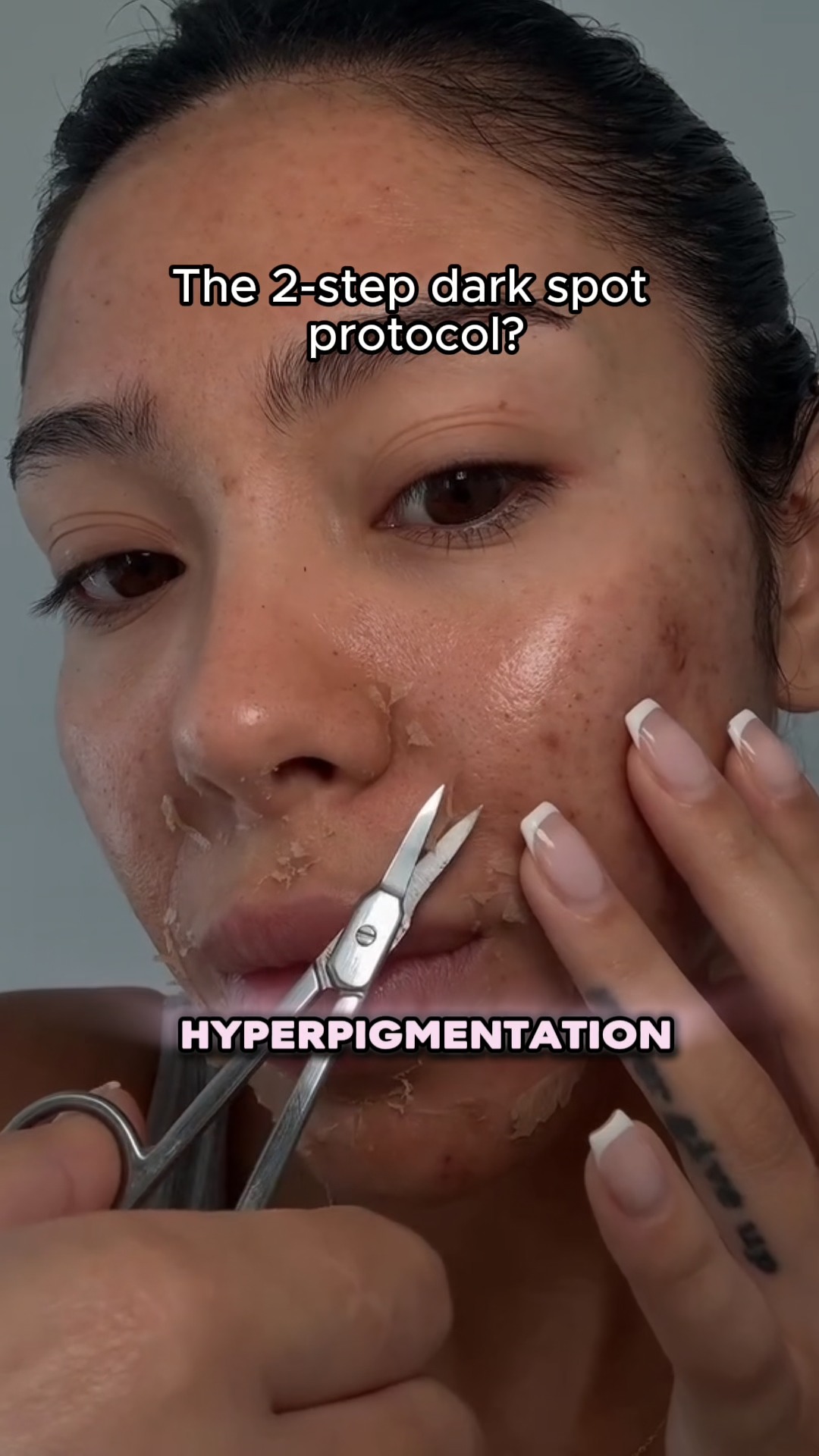 advanced glutathione treatments wellington fl The Jessner Peel offers lightning of post inflammatory pigmentation 💙 Amount:3 Week Intensive Course - 1ml Every 3 Days SNPGluathione Dark Zero Eye Ingredients_Niacinamide