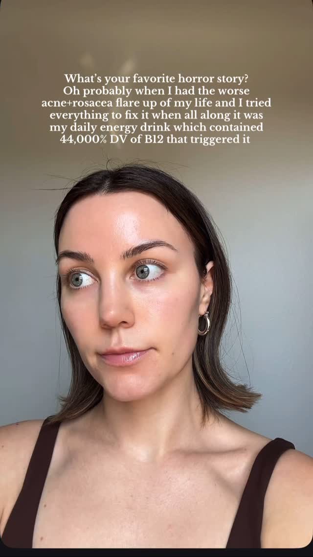 Did you know excessive amounts of B12 can actually be a trigger for acne/rosacea? I met with an acne specialist when I had this flare up and the first thing she ask me was what supplements/energy