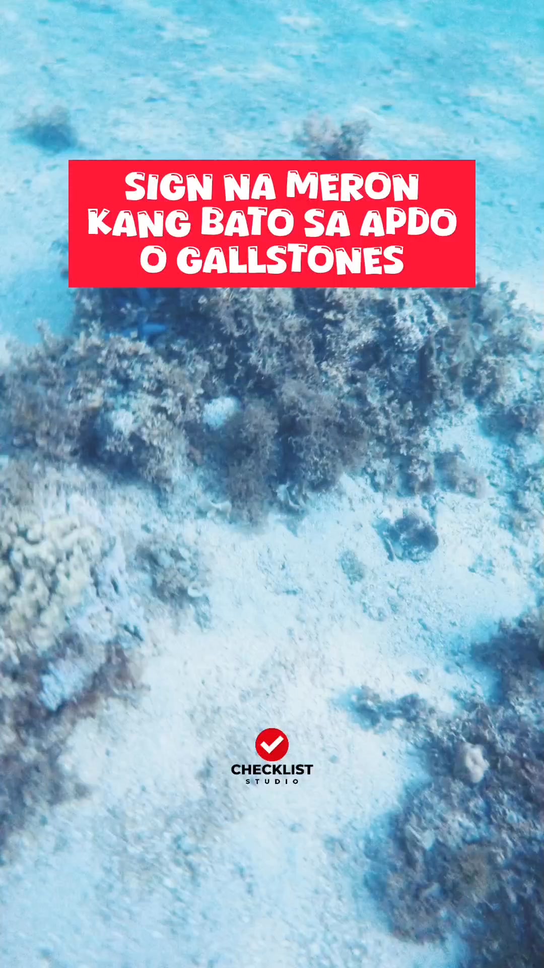 SIGN NA MERON KANG BATO SA APDO O GALLSTONES | Checklist Studio | Facebook