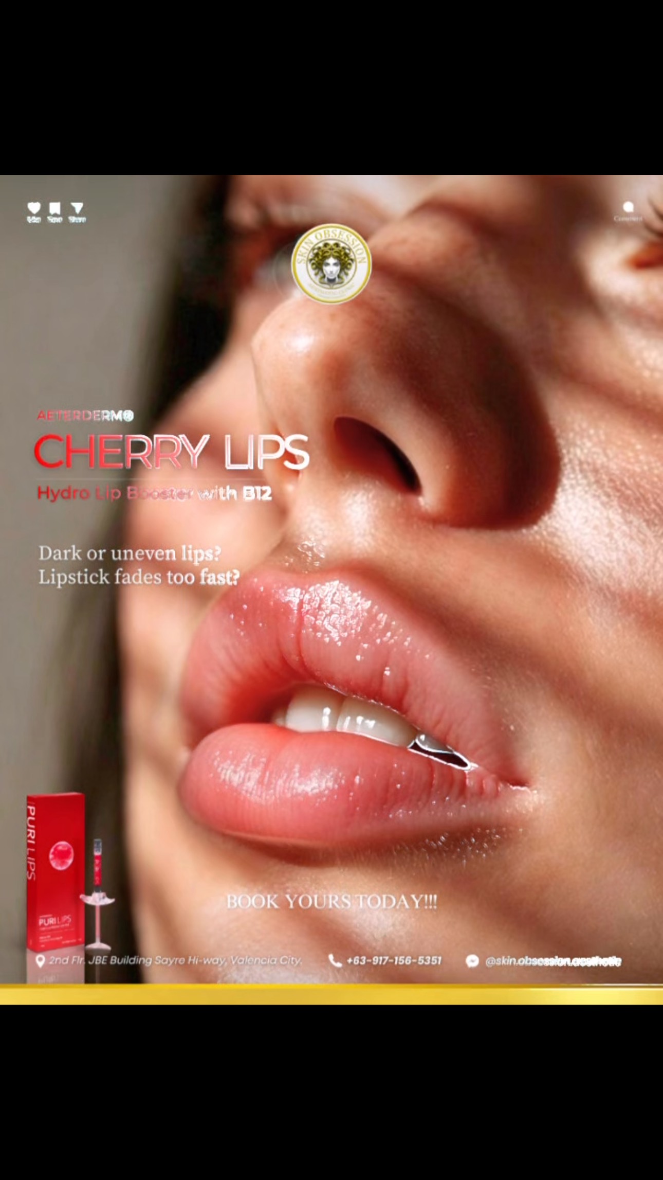 his lips covered in c Fall Love with Your Natural Again.🍒, Got Dark or Uneven Lips? We’ve Got You Covered..., Confidence starts with the little details., Healthy, hydrated, naturally cherry rose lips can , brighten cjc-1295 ipamorelin peptide &