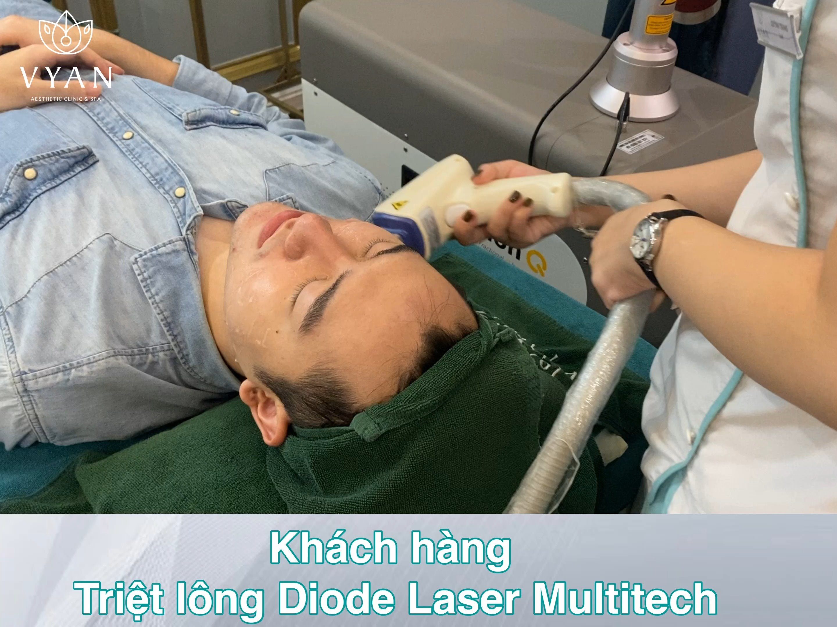 Triệt lông DIODE LASER MULTI - TECH | NAM GIỚI CÓ NÊN TRIỆT 