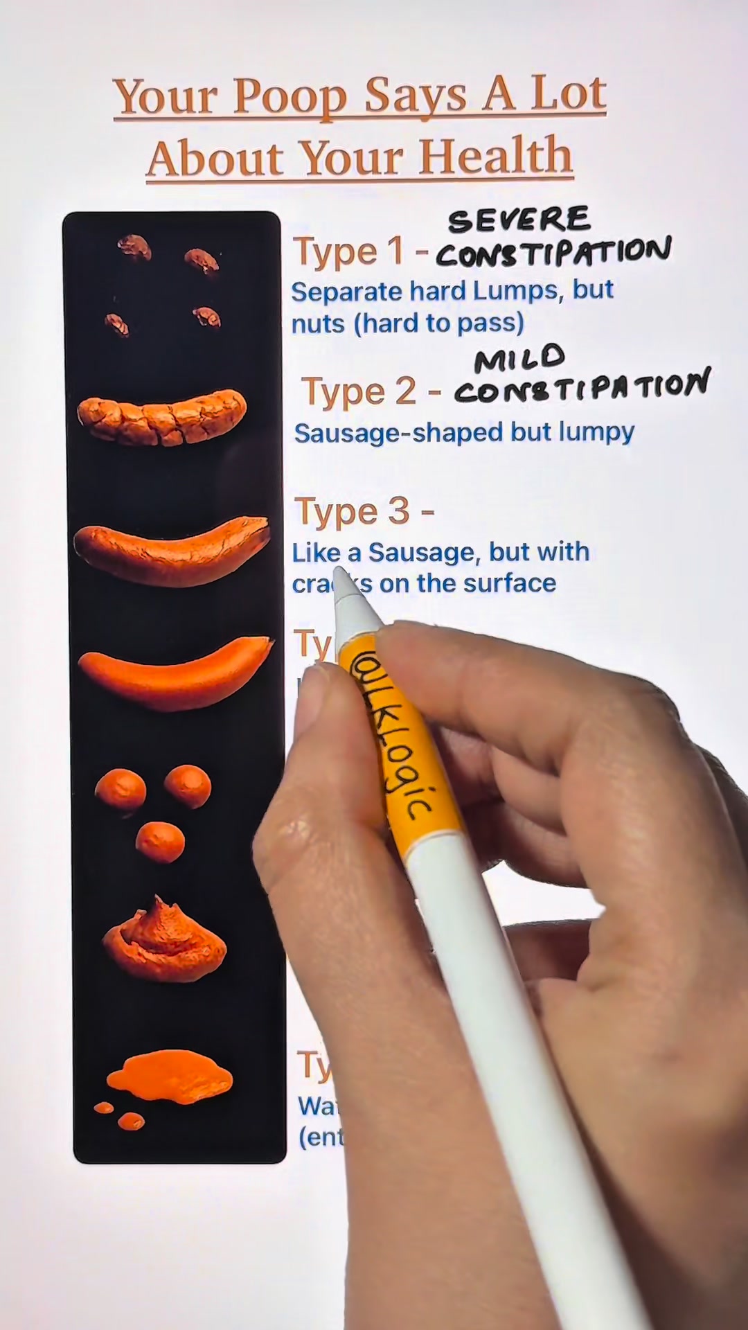 Your poop says a lot about your health! | LK Logic | Facebook
