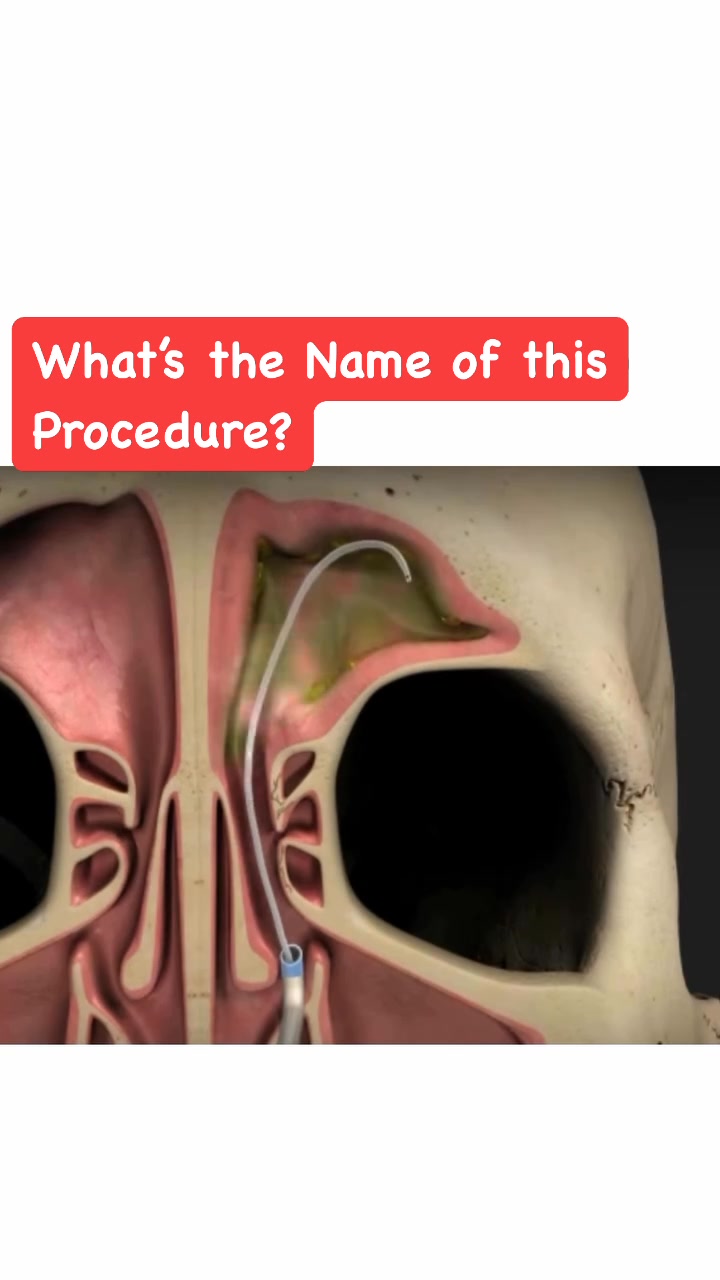 What’s the Name of your Procedure? | Medical Talks | Facebook