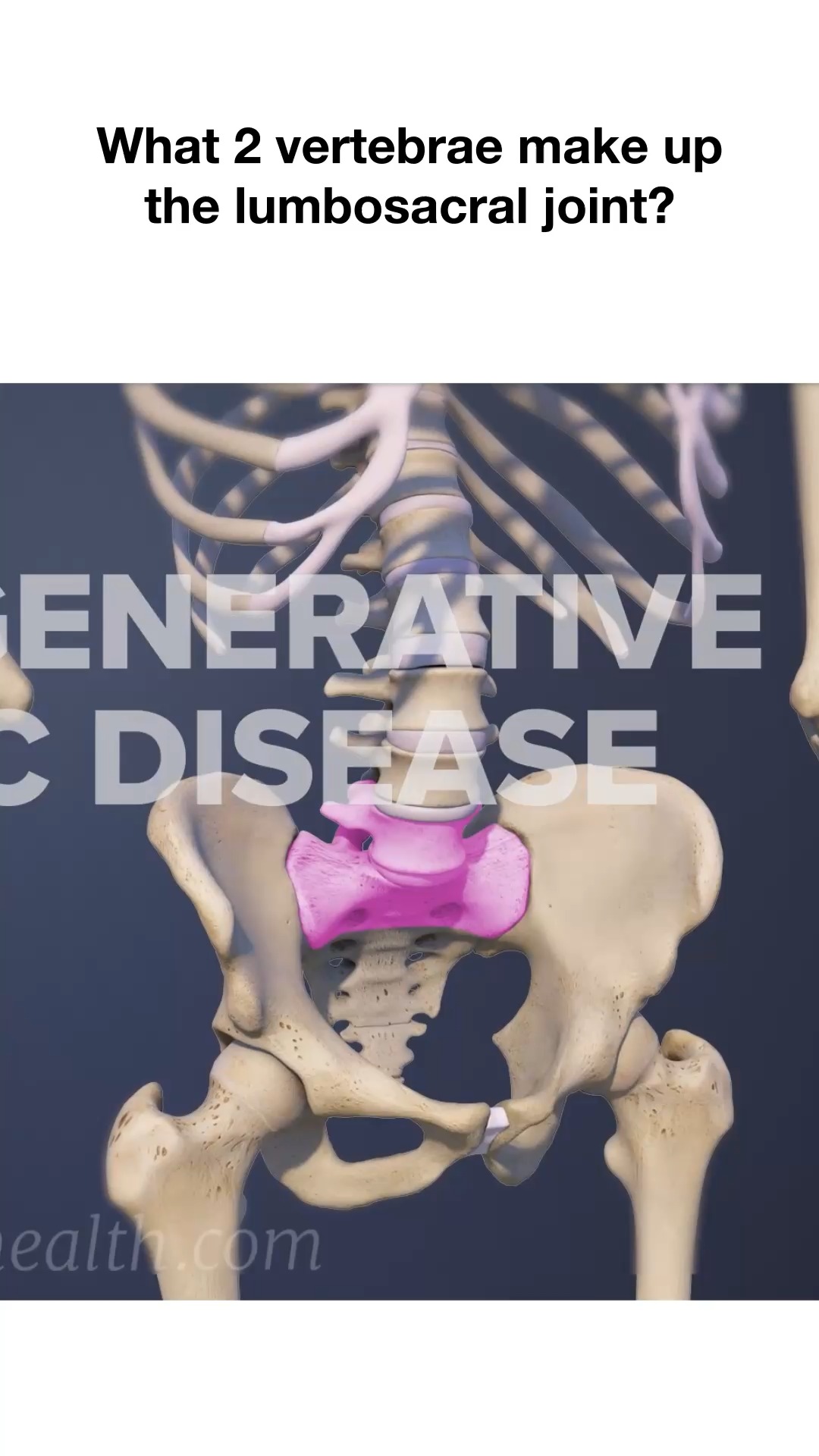 Need to know which vertebrae form the lumbosacral joint? 🦴 This quick ...