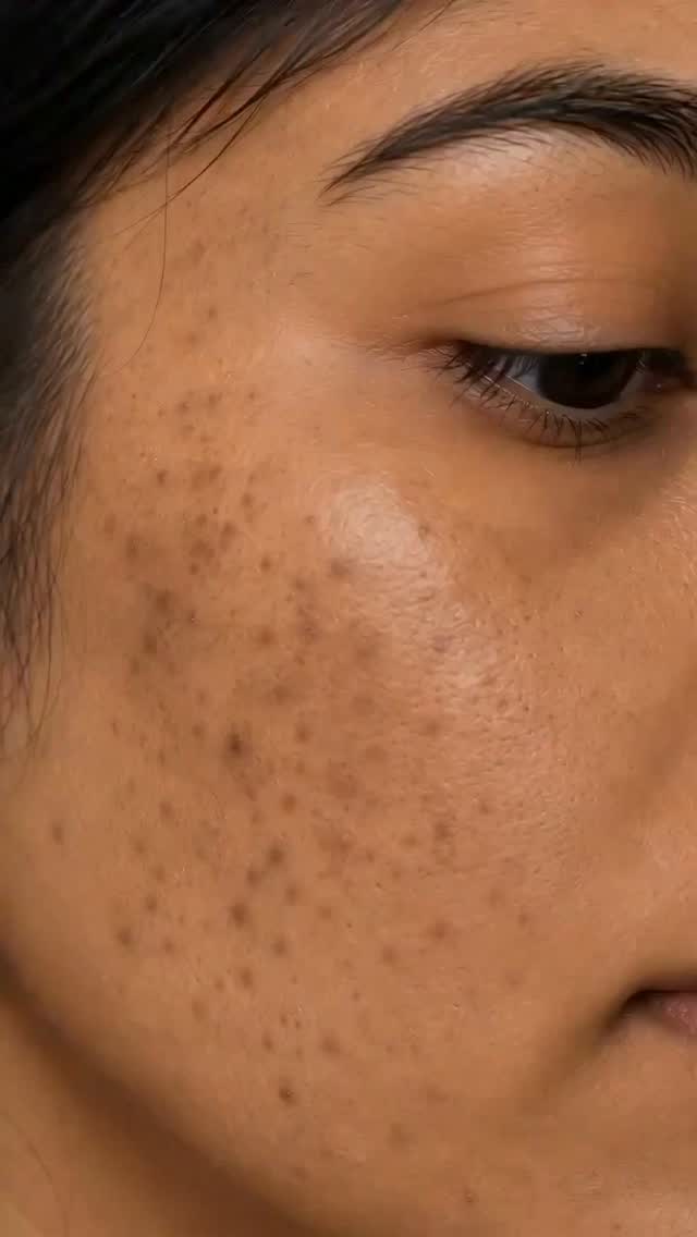 Glutathione night cream ✨ Glutathione is extremely effective in lightening pigmentation, acne scars and helps with uneven skin tone. Made with gentle ingredients and no bl