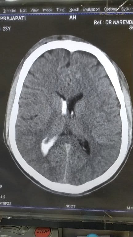 30 y/m pt present with RTA head injury... . . . . . #fbreels2025ツ ...