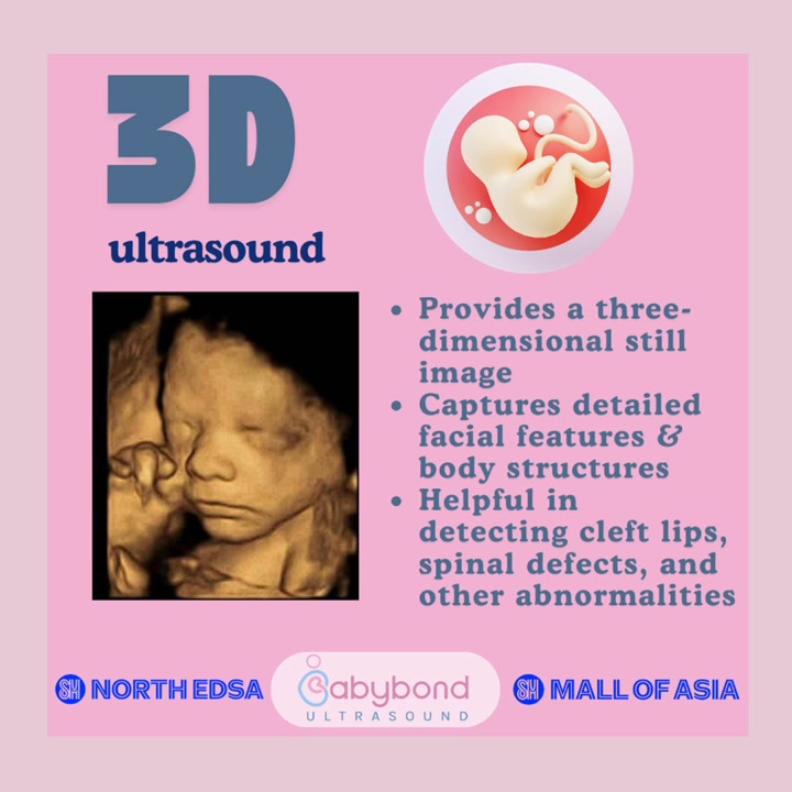 Curious about the difference between 2D, 3D, 4D, and 5D ultrasound?🤔 👶 ...