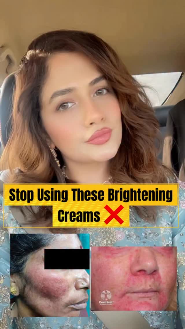 📌 Skin Brightening Creams That I Never Recommend To My Patients. 🗒️ I Made This Video Because I See A Lot Of People Misusing Different Dangerous Creams. • Cream For Pigmentation