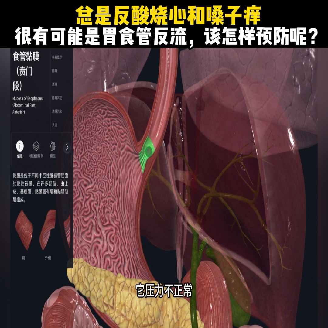 总是反酸烧心和嗓子痒，很有可能是胃食管反流，该怎样预防呢？ | 世界科普3 | Facebook