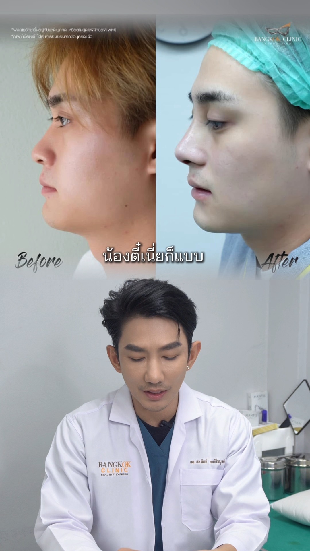 Bangkok Clinic Wellness Center สาขาคันคลอง เชียงใหม่ - 🧬 V-Lift Plus ...